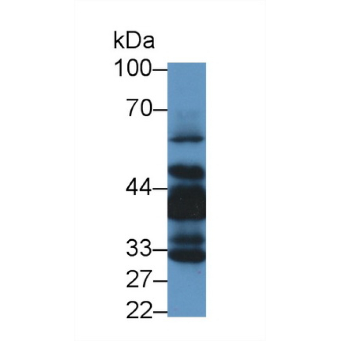 LIM And Senescent Cell Antigen Like Domains Protein 1 (LIMS1) Human Polyclonal Antibody