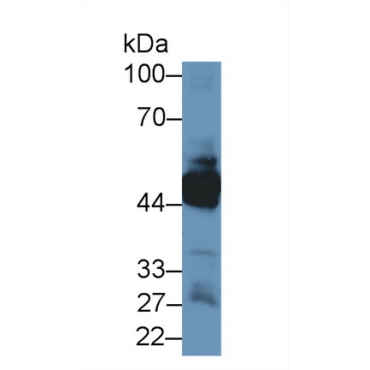Keratin 33A (KRT33A) Human Polyclonal Antibody