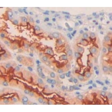 Potassium Inwardly Rectifying Channel Subfamily J, Member 10 (KCNJ10) Human Polyclonal Antibody