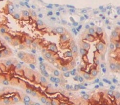 Potassium Inwardly Rectifying Channel Subfamily J, Member 10 (KCNJ10) Human Polyclonal Antibody