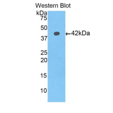Histone Cluster 1, H2ad (HIST1H2AD) Human Polyclonal Antibody