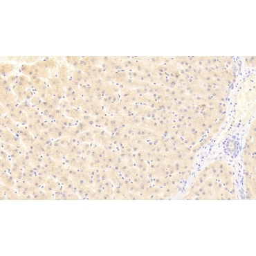 Dickkopf Related Protein 4 (DKK4) Human Polyclonal Antibody
