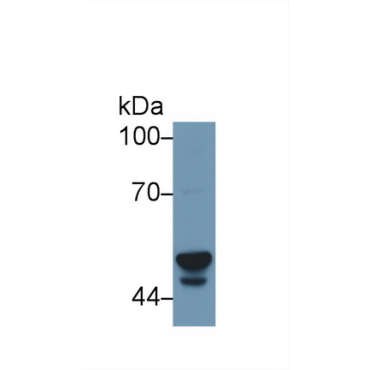 Cytochrome P450 3A7 (CYP3A7) Human Polyclonal Antibody