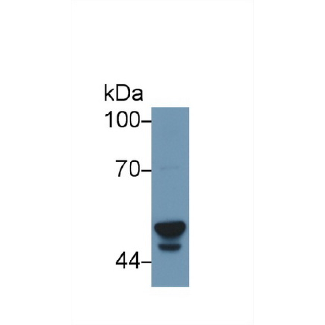 Cytochrome P450 3A7 (CYP3A7) Human Polyclonal Antibody