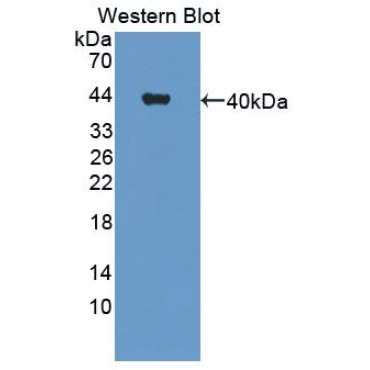L1CAM (CHL1) Human Polyclonal Antibody