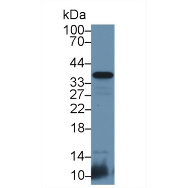 Cluster Of Differentiation 8b (CD8b) Mouse Polyclonal Antibody