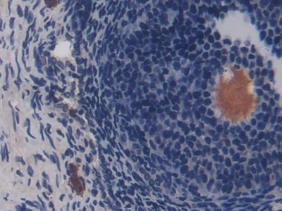 Cluster Of Differentiation 8b (CD8b) Rat Polyclonal Antibody