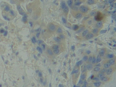 BMX Non Receptor Tyrosine Kinase (BMX) Human Polyclonal Antibody