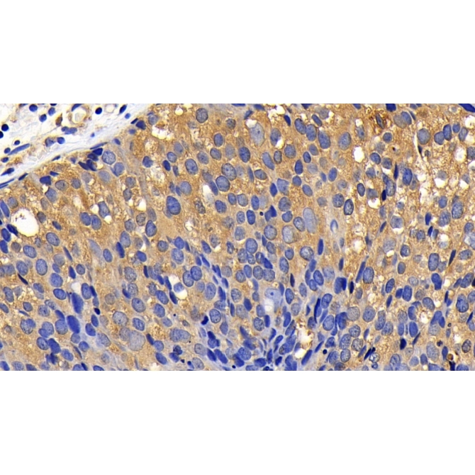 Bcl2 Like Protein 11 (BCL2L11) Human Polyclonal Antibody