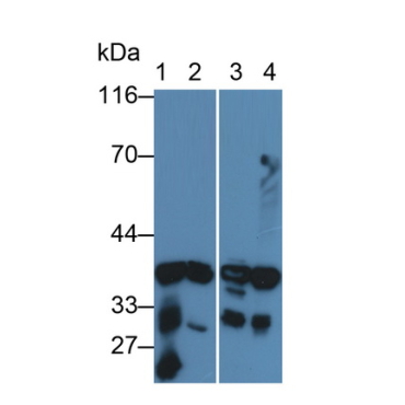 Aldose Reductase Like Protein 1 (ARL1) Human Polyclonal Antibody