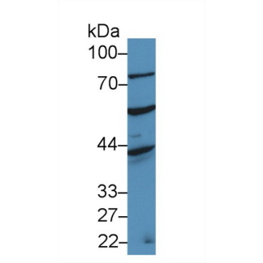 A Disintegrin And Metalloprotease 20 (ADAM20) Human Polyclonal Antibody