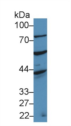 A Disintegrin And Metalloprotease 20 (ADAM20) Human Polyclonal Antibody