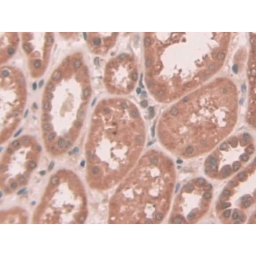ATP Binding Cassette Transporter C10 (ABCC10) Human Polyclonal Antibody