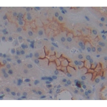 NADH Dehydrogenase 1 (ND1) Human Polyclonal Antibody