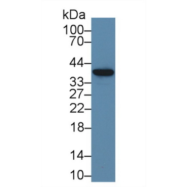 NADH Dehydrogenase 1 (ND1) Human Polyclonal Antibody