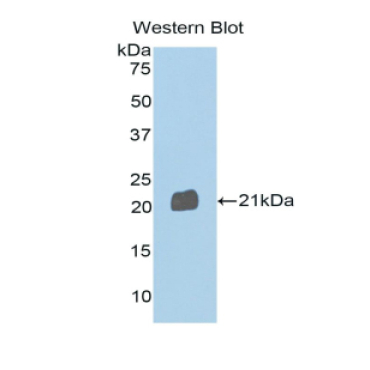 Semaphorin 4B (SEMA4B) Human Polyclonal Antibody