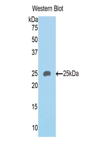 Semaphorin 4B (SEMA4B) Mouse Polyclonal Antibody