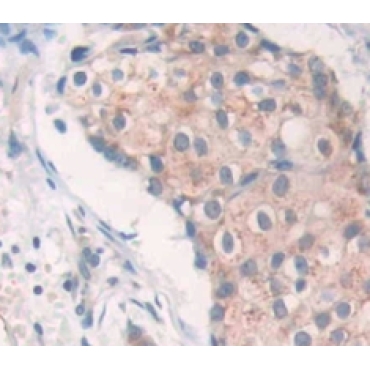 SRSF Protein Kinase 3 (SRPK3) Human Polyclonal Antibody