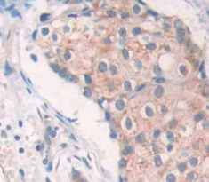 SRSF Protein Kinase 3 (SRPK3) Human Polyclonal Antibody