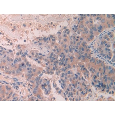 Signal Peptide, CUB Domain, EGF Like 3 (SCUBE3) Human Polyclonal Antibody