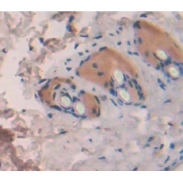 Interleukin 1 Theta (IL1q) Human Polyclonal Antibody