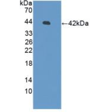 Defensin Beta 126 (DEFb126) Human Polyclonal Antibody