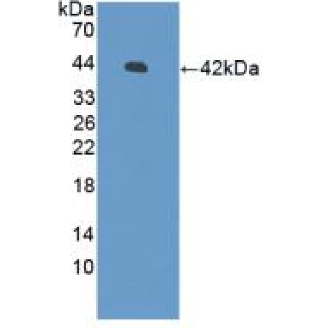 Defensin Beta 126 (DEFb126) Human Polyclonal Antibody