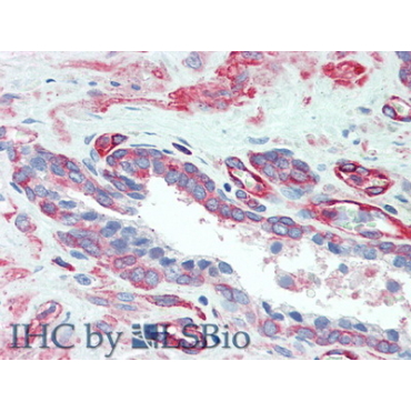 Myosin Light Chain 12A (MYL12A) Human Polyclonal Antibody