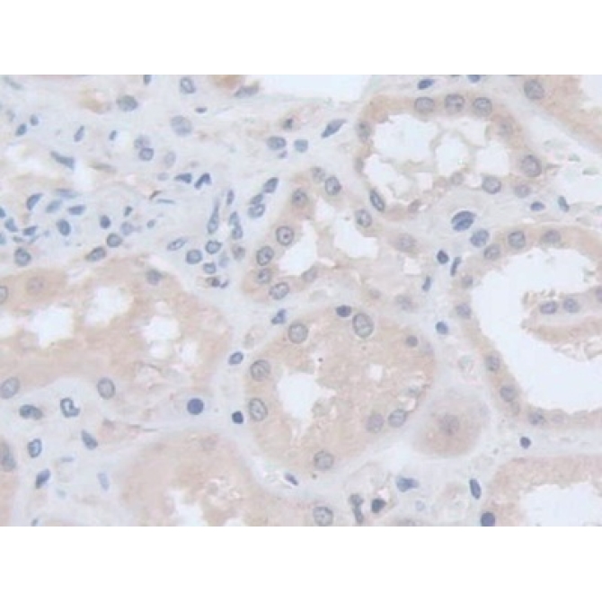 Echinoderm Microtubule Associated Protein Like Protein 2 (EML2) Human Polyclonal Antibody