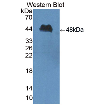 Peptidase Inhibitor 16 (PI16) Bovine (Cattle) Polyclonal Antibody