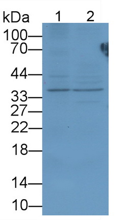 Peptidase Inhibitor 16 (PI16) Human Polyclonal Antibody