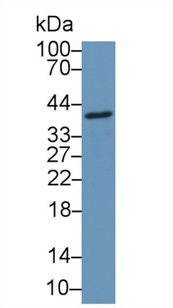 Coiled Coil Domain Containing Protein 3 (CCDC3) Human Polyclonal Antibody