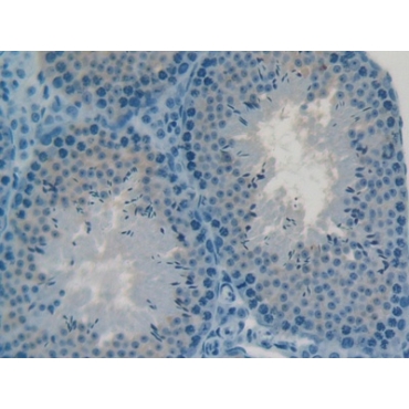 C2 Calcium Dependent Domain Containing Protein 3 (C2CD3) Mouse Polyclonal Antibody