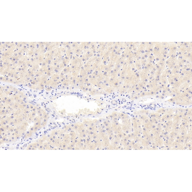 Coenzyme Q10 Homolog B (COQ10B) Human Polyclonal Antibody