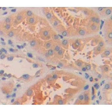 ADP Ribosylation Factor Like Protein 15 (ARL15) Human Polyclonal Antibody