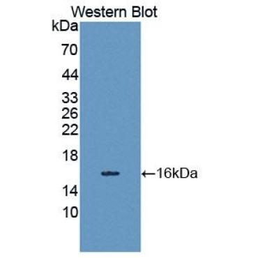 Spindlin 3 (SPIN3) Human Polyclonal Antibody