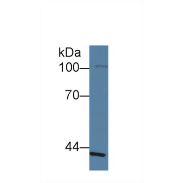 Schlafen Family Member 5 (SLFN5) Human Polyclonal Antibody