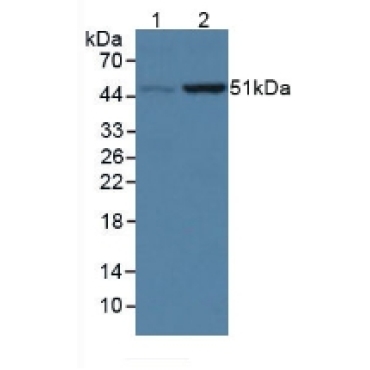 Coenzyme Q6 Homolog, Monooxygenase (COQ6) Human Polyclonal Antibody