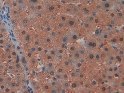 RAD54 Like Protein 2 (RAD54L2) Human Polyclonal Antibody