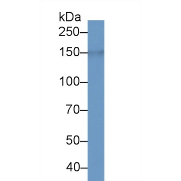 LIM And Calponin Homology Domains Containing Protein 1 (LIMCH1) Mouse Polyclonal Antibody
