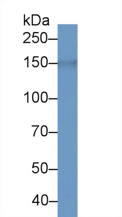 LIM And Calponin Homology Domains Containing Protein 1 (LIMCH1) Mouse Polyclonal Antibody