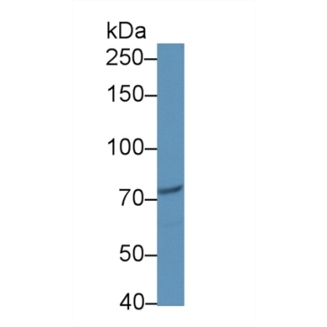 Cancerous Inhibitor Of PP2A (CIP2A) Human Polyclonal Antibody