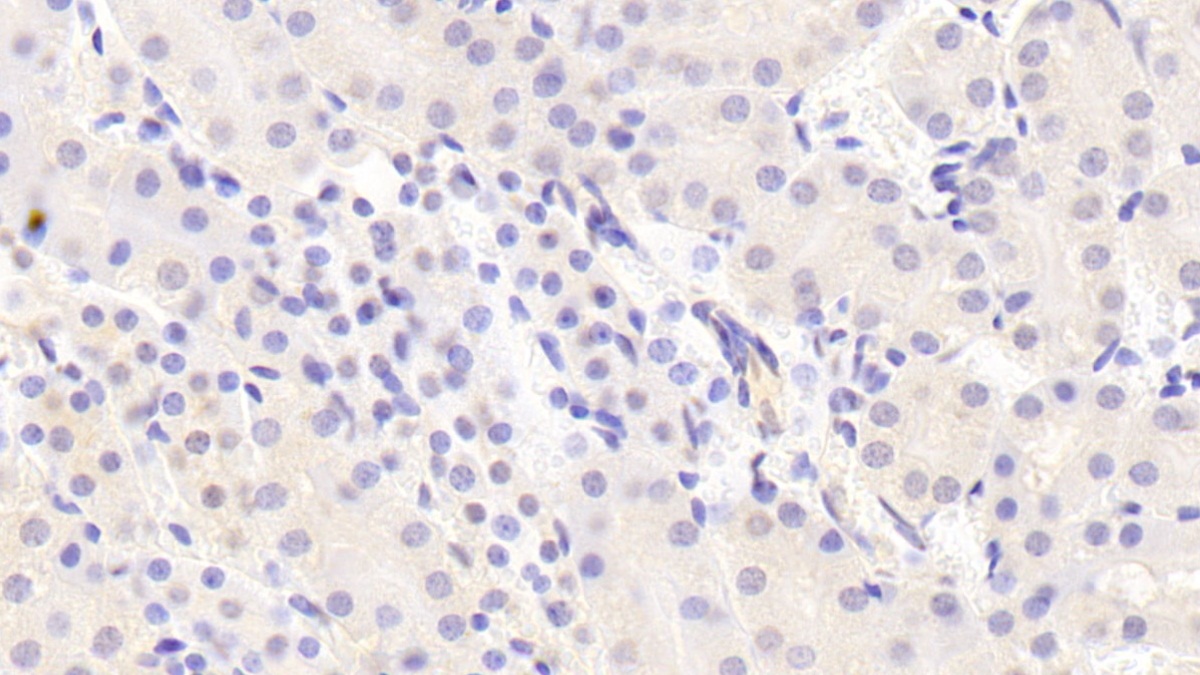 Raft Linking Protein (Raftlin) Mouse Polyclonal Antibody