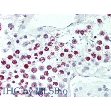 Histone (H) Human Polyclonal Antibody
