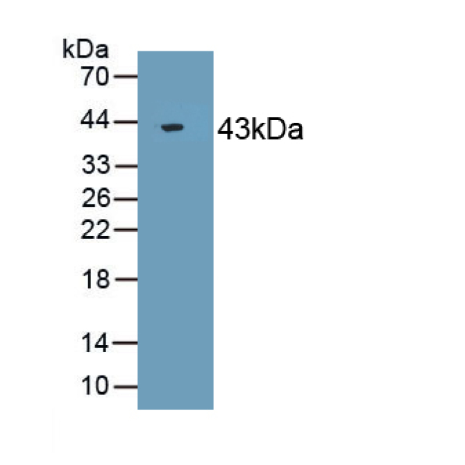 Actin (ACTIN) Human Polyclonal Antibody