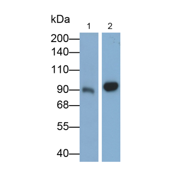 Complement Component 4d (C4d) Human Polyclonal Antibody