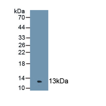 Complement Component 4c (C4c) Human Polyclonal Antibody