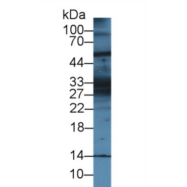 Keratin 28 (KRT28) Mouse Polyclonal Antibody