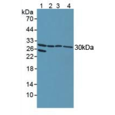 Notch2 N-Terminal Like Protein (NOTCH2NL) Human Polyclonal Antibody