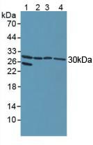 Notch2 N-Terminal Like Protein (NOTCH2NL) Human Polyclonal Antibody